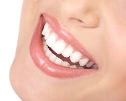 teeth whitening