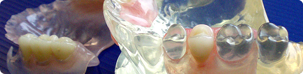 flexible dentures